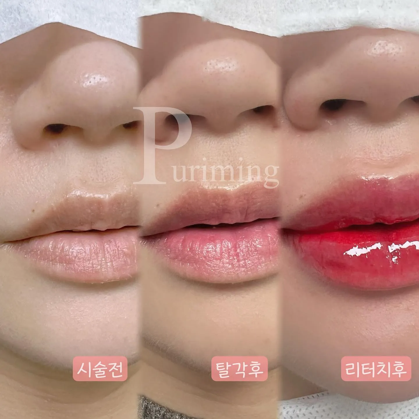 입술 두 번째 작품 예시