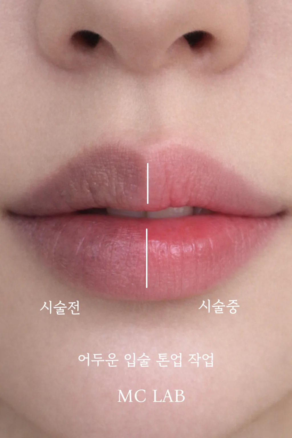 입술 다섯 번째 작품 예시
