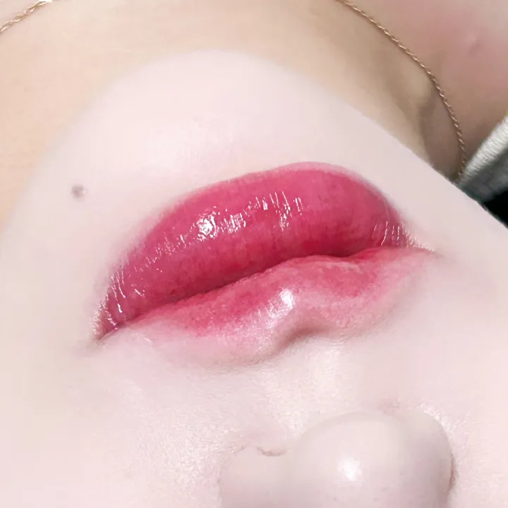 리터치가 필요한 이유와 시기 관련 입술 시술 예시