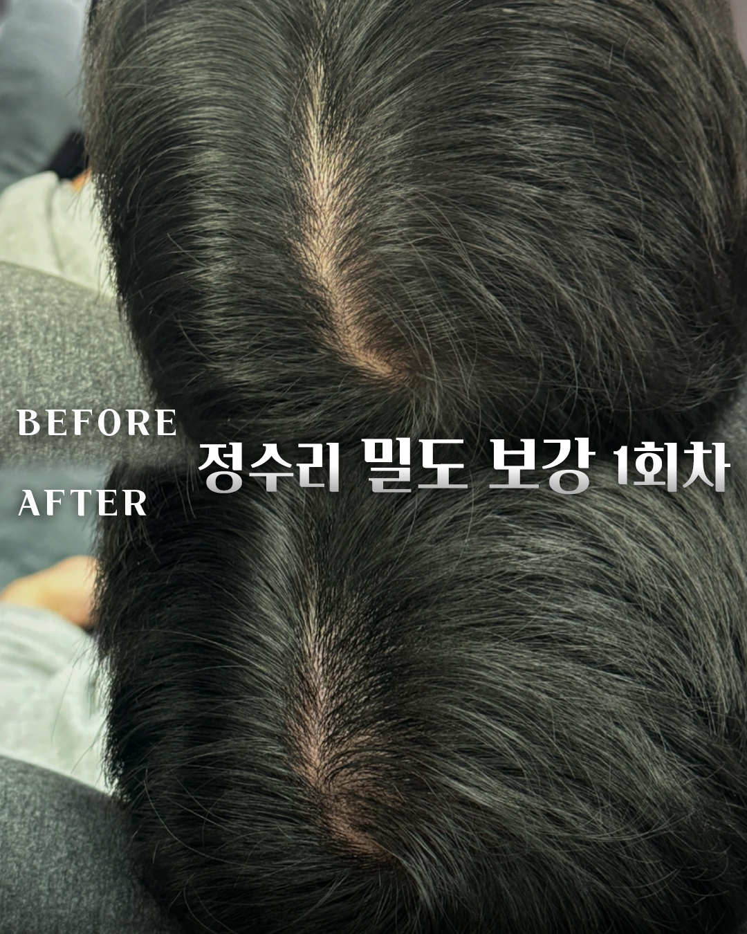 반영구알레르기 두 번째 작품 예시
