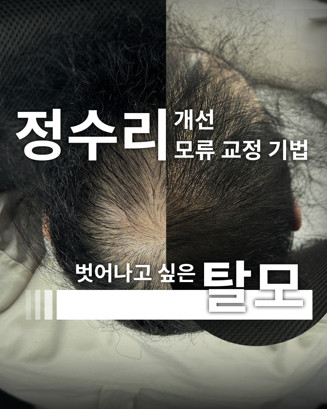 반영구알레르기 다섯 번째 작품 예시
