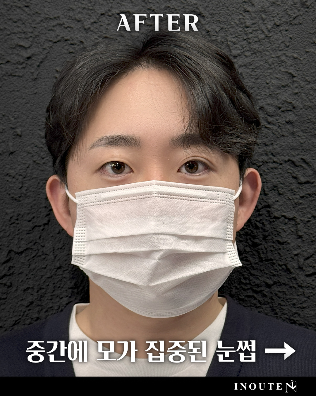 흉터커버 대표 작품 예시