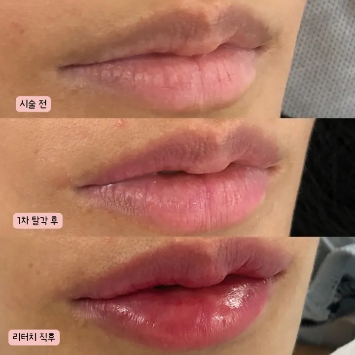 입술 여섯 번째 작품 예시