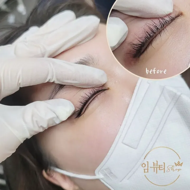 안전한 아이라인 시술을 위한 체크리스트 관련 아이라인 시술 예시