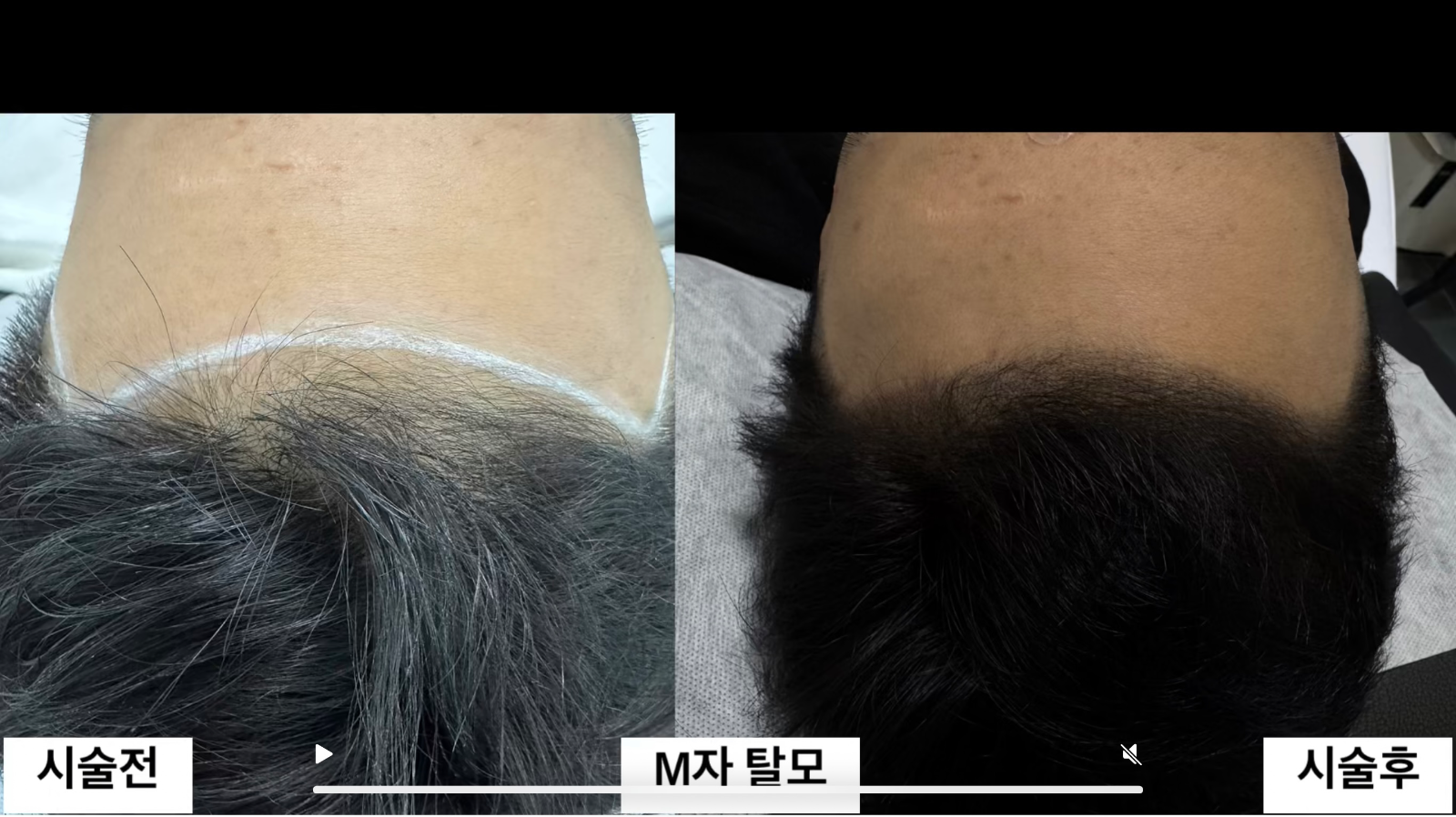 반영구위생 네 번째 작품 예시