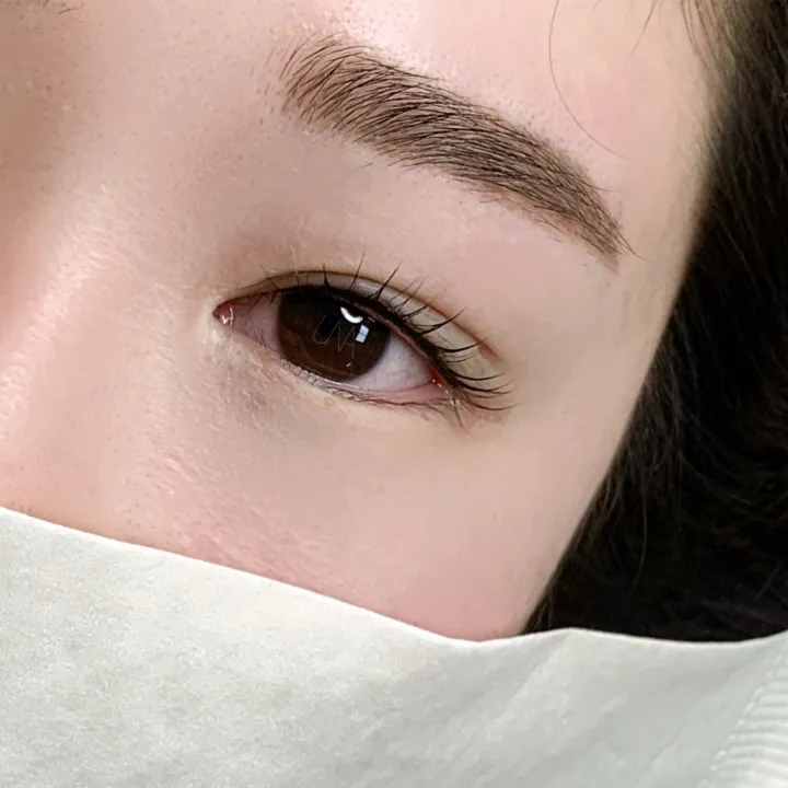 서울 마포구 아이라인 반영구 시술 전 알아야 할 모든 것