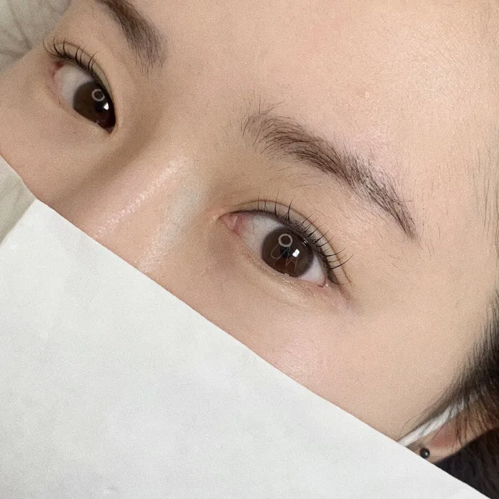 시술 전후 관리 팁과 실질적 조언 관련 속눈썹 시술 예시