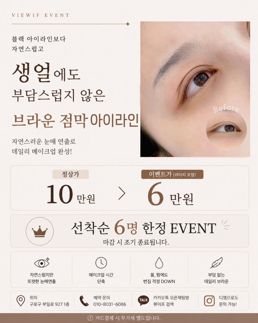 유사 시술과의 비교: 아이라인 시술의 장단점 관련 아이라인 시술 예시