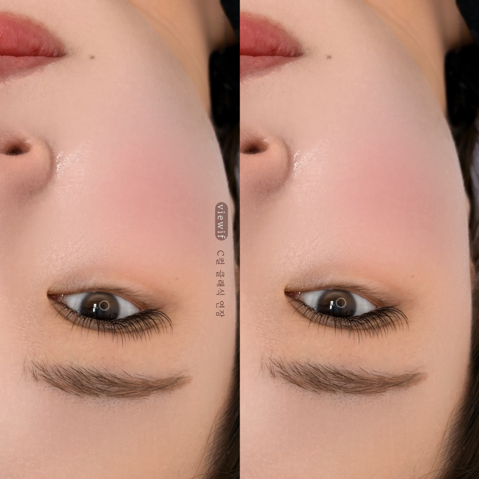 반영구제거 다섯 번째 작품 예시