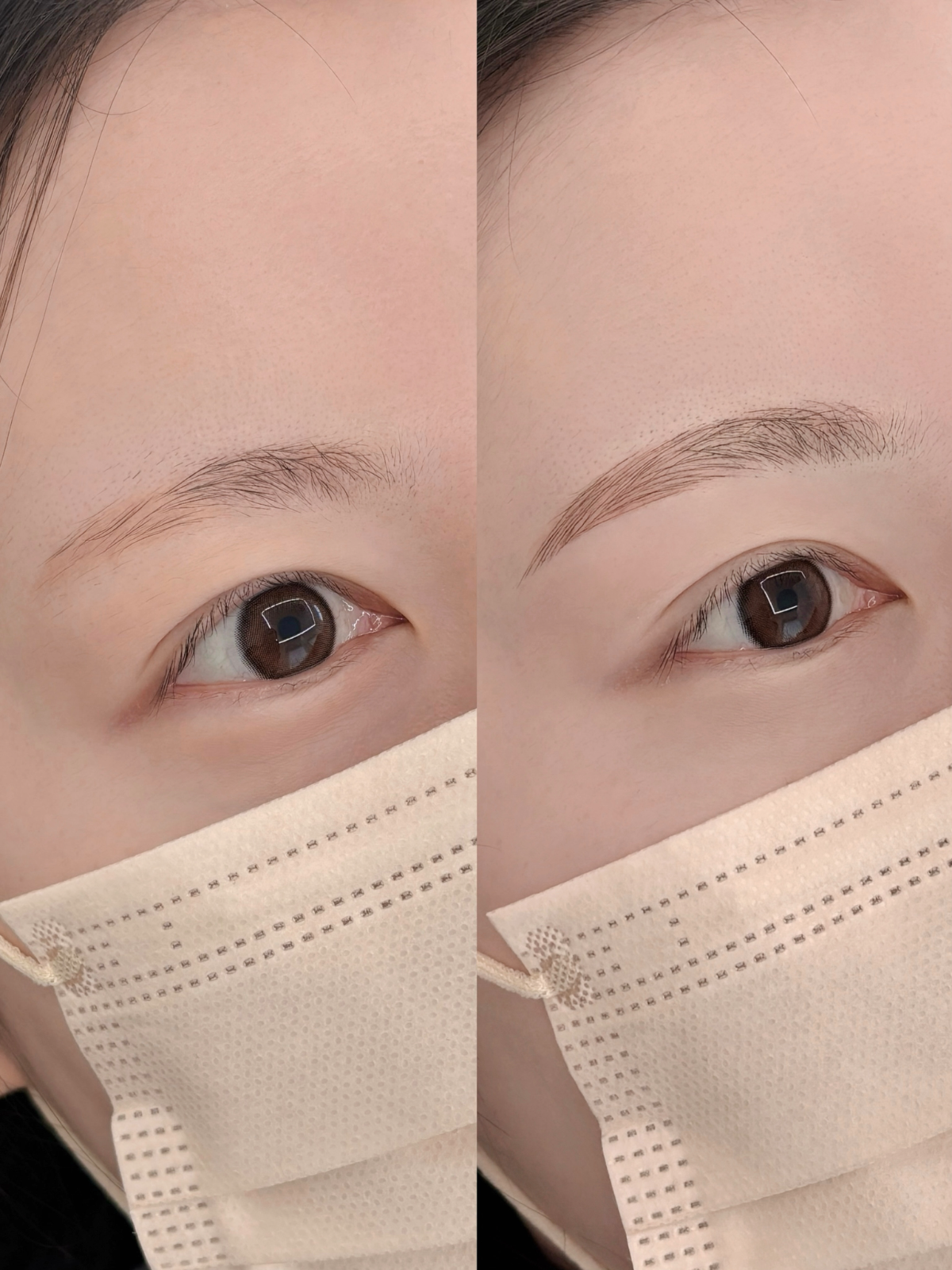 반영구알레르기 네 번째 작품 예시